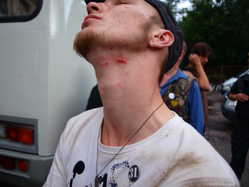 Триумфальная площадь, 31 июля 2011-го года